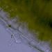 Kořen <i>Ranunculus repens</i> - odlupující se buňka kořenové čepičky