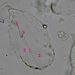 Parenchymatická buňka z dužniny bobule <i>Symphoricarpos albus</i>