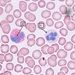 Krev: leukocyty – neutrofil + eosinofil