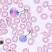 Krev: leukocyty – eosinofil + lymfocyt