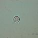 Cyclotella stelligera (CLEVE & GRUNOW)