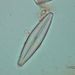 Navicula lanceolata (AGARDH) EHRENBERG 2