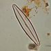 Navicula lanceolata (AGARDH) EHRENBERG